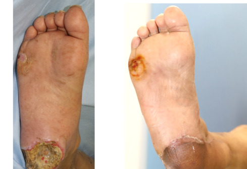 AnnieCare® GlucoRelix Diabetes Treatment Softgels