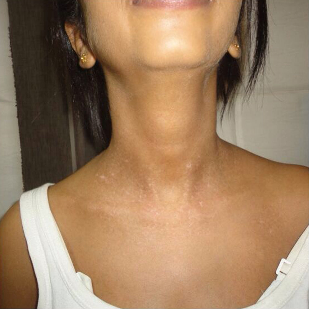 YUNPSO® VitiHeali Yellowjacket Neurotoxic fluid Extractm Cream Ultra 42 YUNPSO® VitiHeali Yellowjacket Neurotoxic fluid Extractm Cream Ultra