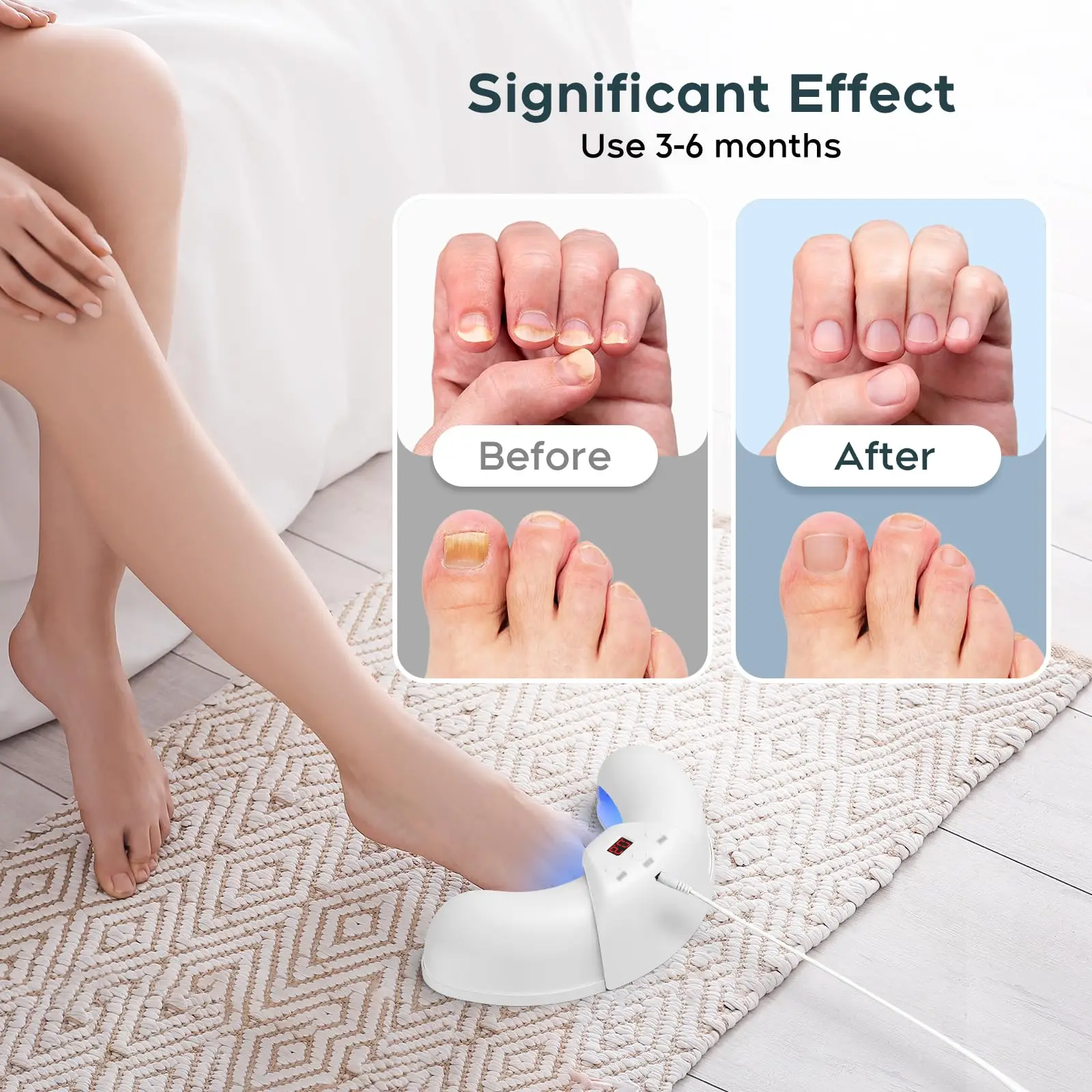 Nail Laser Fungus Device for Multiple Toenails & fingernails Nail Repair Solution for Damaged and Discolored Nails for Home Use