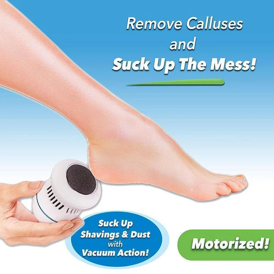 Electric Callus Remover