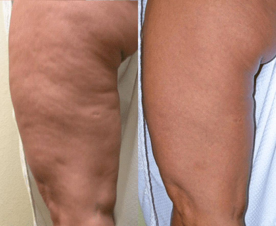 NATRAVOR® AuréLuxe Body Firming Oil image NATRAVOR® AuréLuxe Body Firming Oil