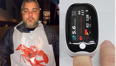 š„10,000+ sold in last 30 day_Non-invasive Precision Multifunctional Medical Device