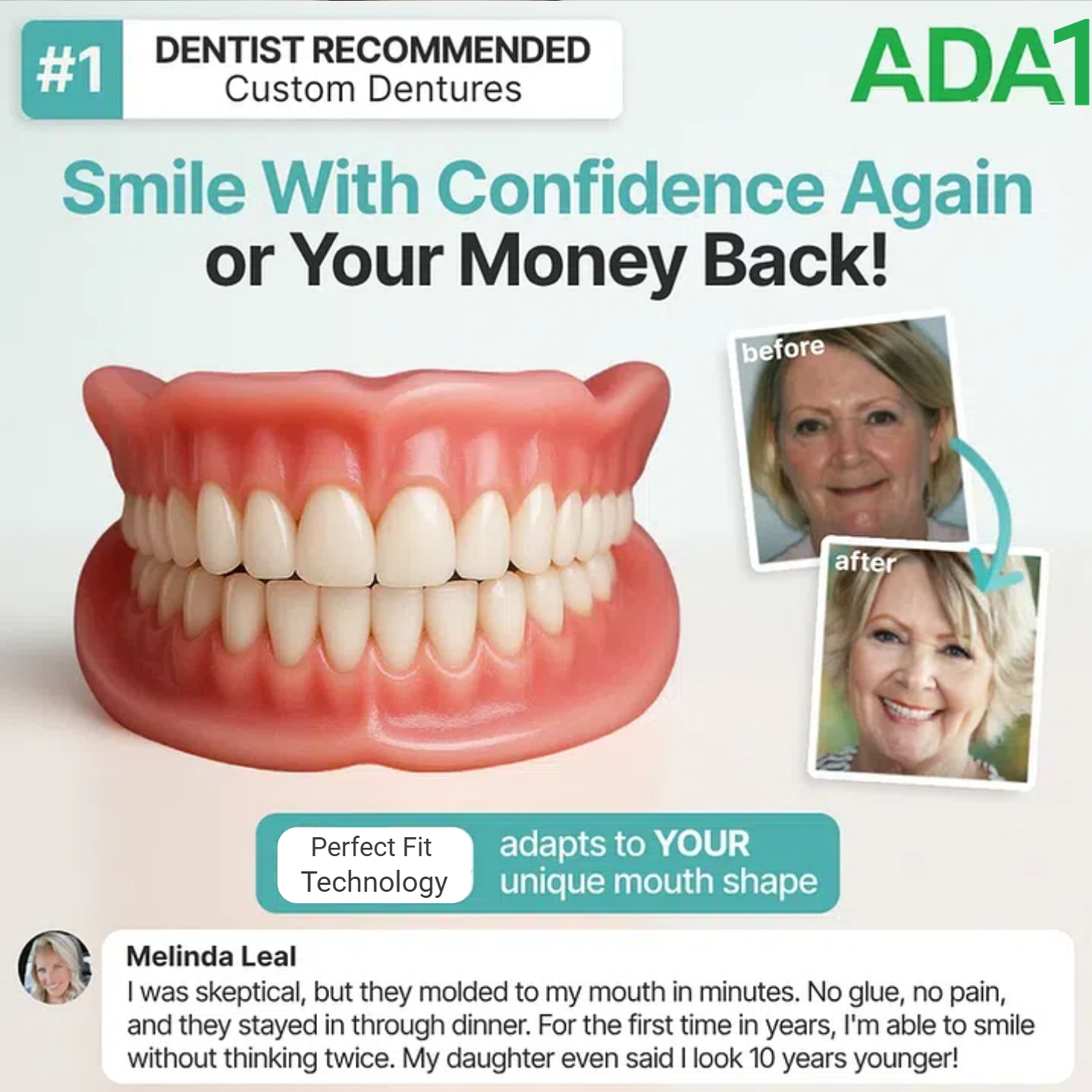 ROSOPL™ Advanced Custom Fit Denture Set image ROSOPL™ Advanced Custom Fit Denture Set