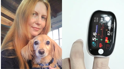 š„10,000+ sold in last 30 day_Non-invasive Precision Multifunctional Medical Device