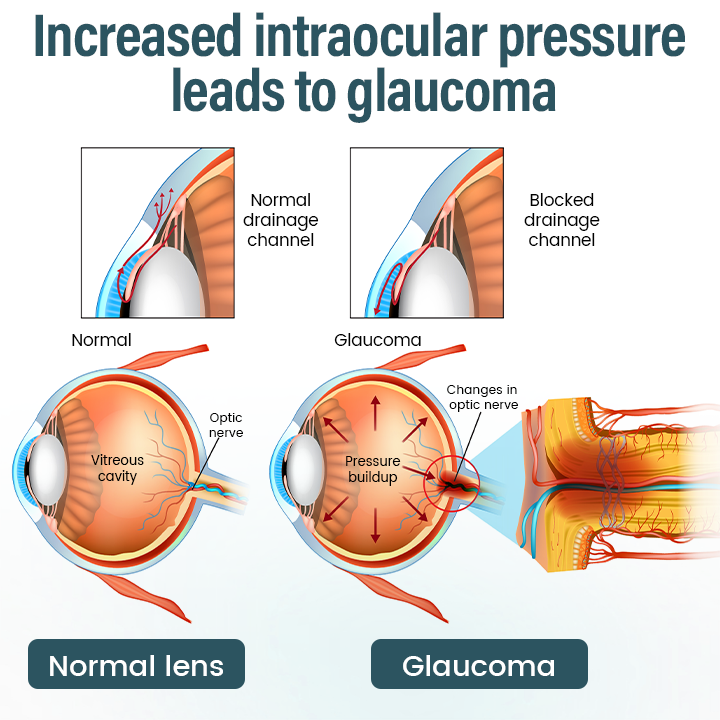LAOZIK™ OptiFusion Nano Eye Drops Serum —Nano Technology Restores Clear Vision, No Glasses, No Surgery