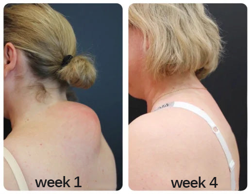 LAOZIK™ Turmeric & Emu Oil Arthritis Soothing Pain Relief Massage Gel Australian Osteopathic Association (AOA) Approved