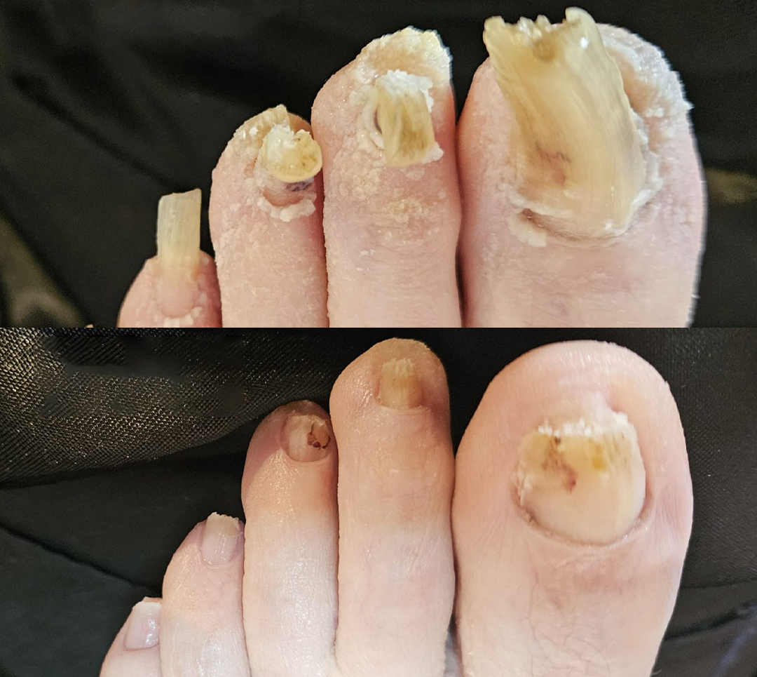 Biancat® AeroFilm Foot Defense Mist