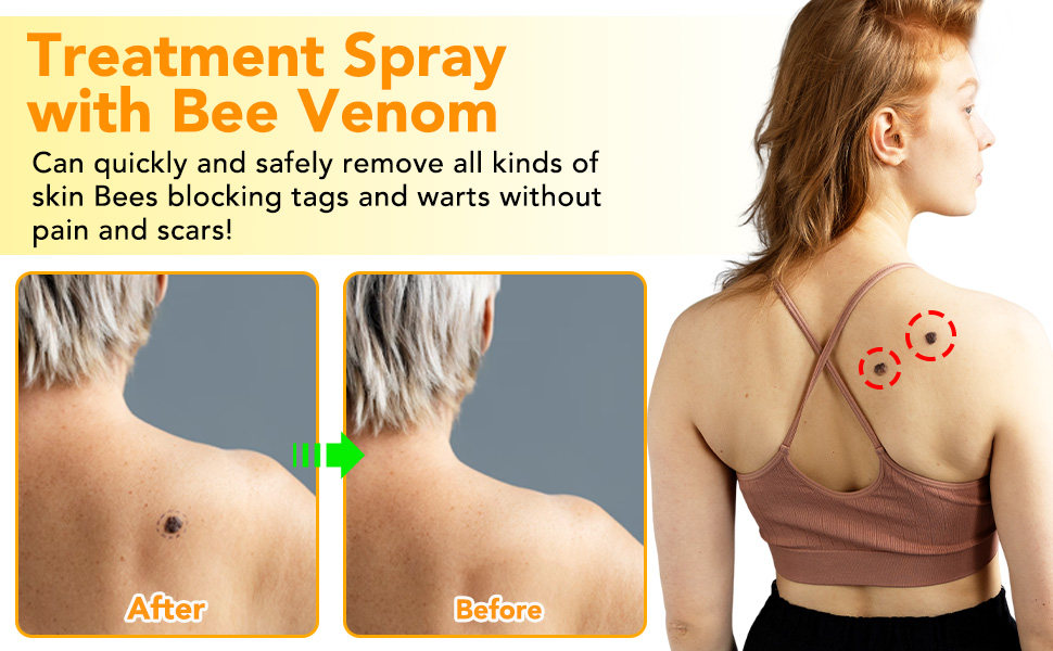 Natural Honey Bee Venom Repair Spray, Bee Venom Hydrating Moisturizing 2pcs