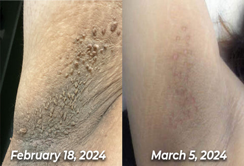 BBOJI™ 7-Day Multi-Effect All-in-One Skincare Cream image BBOJI™ 7-Day Multi-Effect All-in-One Skincare Cream