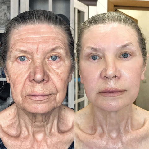 BBOJI™ 7-Day Multi-Effect All-in-One Skincare Cream image BBOJI™ 7-Day Multi-Effect All-in-One Skincare Cream