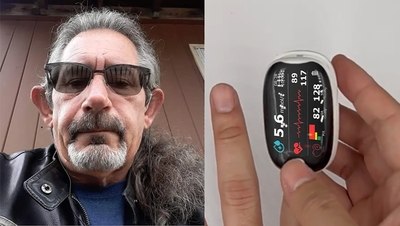 š„10,000+ sold in last 30 day_Non-invasive Precision Multifunctional Medical Device