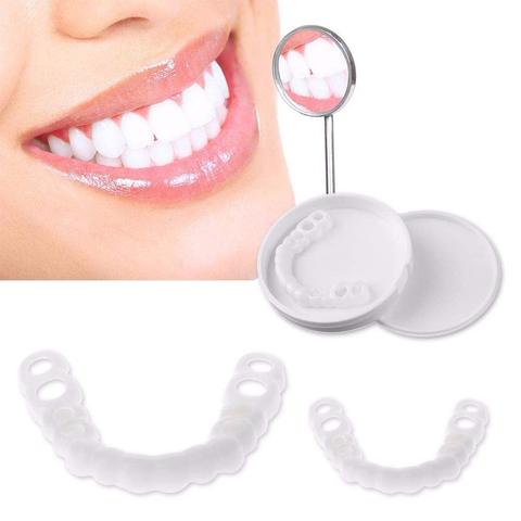 Snap-On Dentures