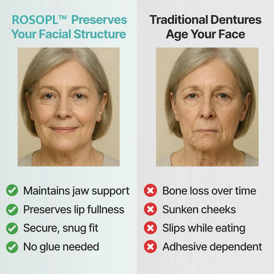 ROSOPL™ Custom-Fit Full Functional Dentures