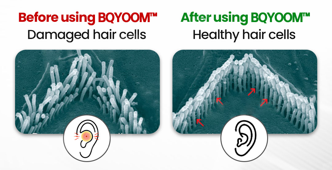 BQYOOM™ NeuroActivation Silence Pro 23 848016f9ddcea43eb7836e546adf2a9a