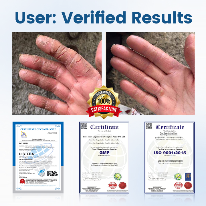 BQYOOM™ AngioVita Diabetic Care Spray