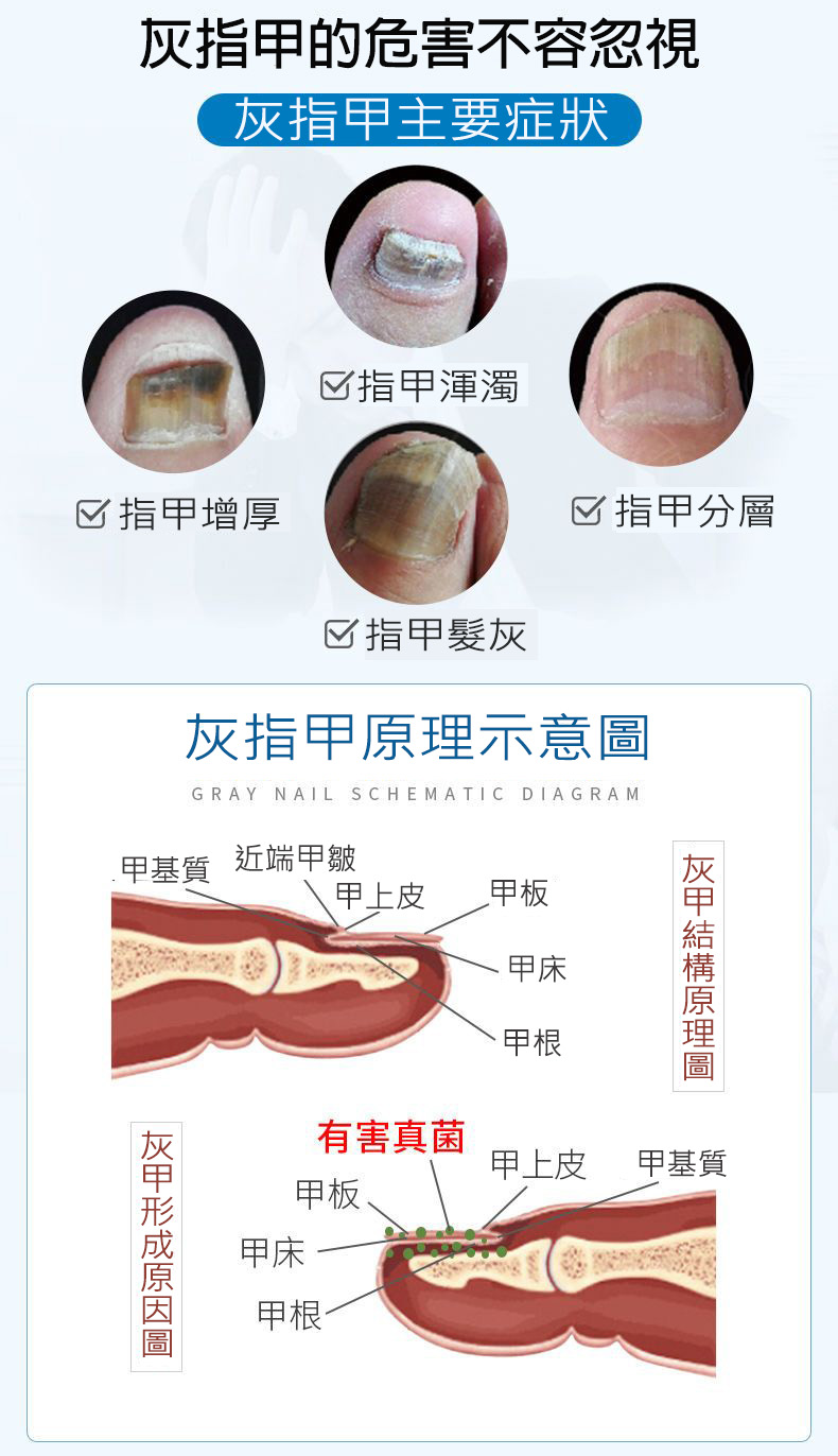 德國SOS灰指甲修復筆