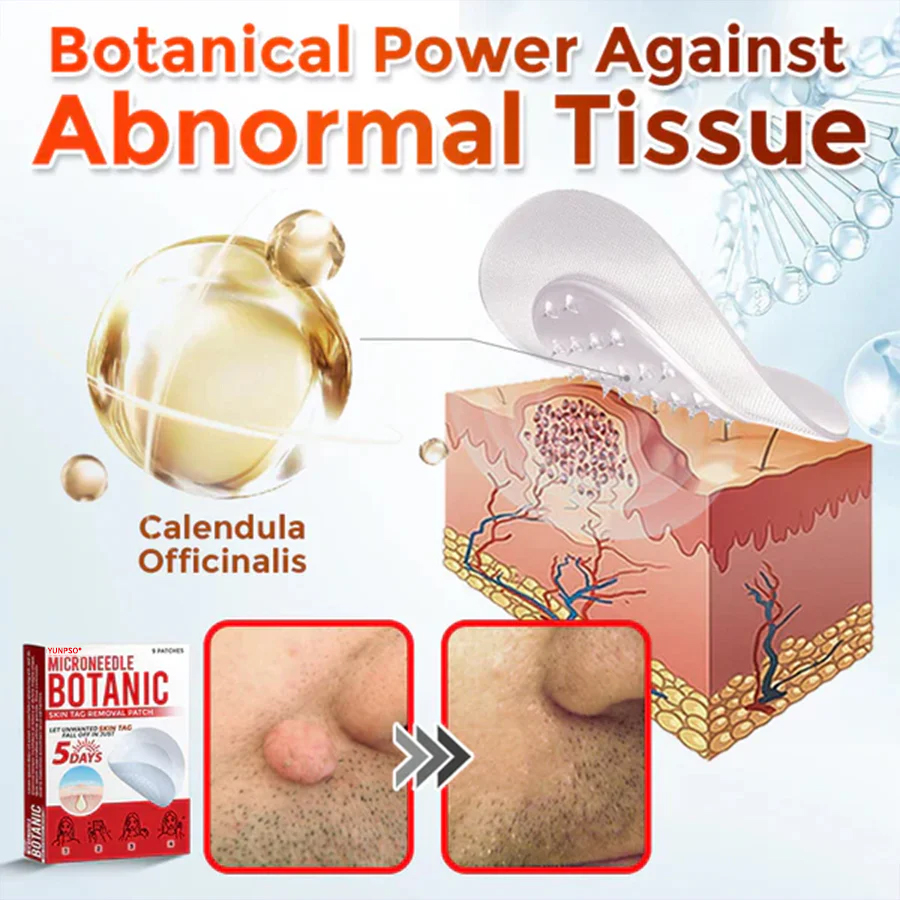 Yunpso™ MicroNeedle Botanic Skin Tag Removal Patch