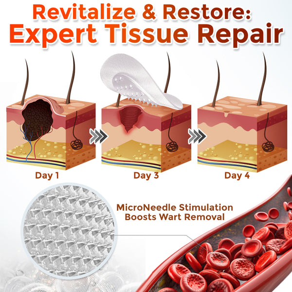 Yunpso™ MicroNeedle Botanic Skin Tag Removal Patch