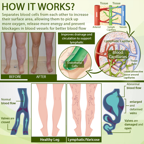 Outeny™ SwellFree Lymphatic Herbal Cream