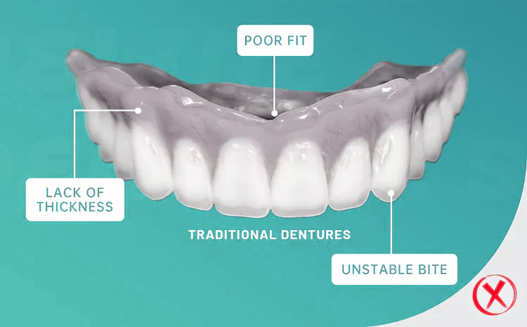 ROSOPL™-Advanced Custom-Fit Functional Dentures image ROSOPL™-Advanced Custom-Fit Functional Dentures