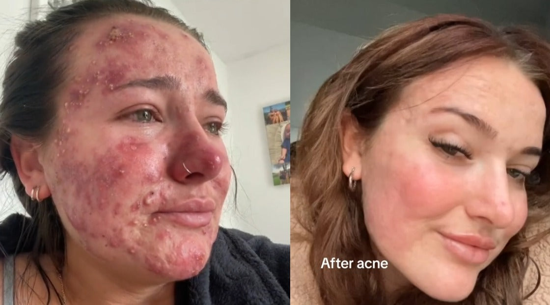 978291b314575d4ff8d0830b0a44e52d