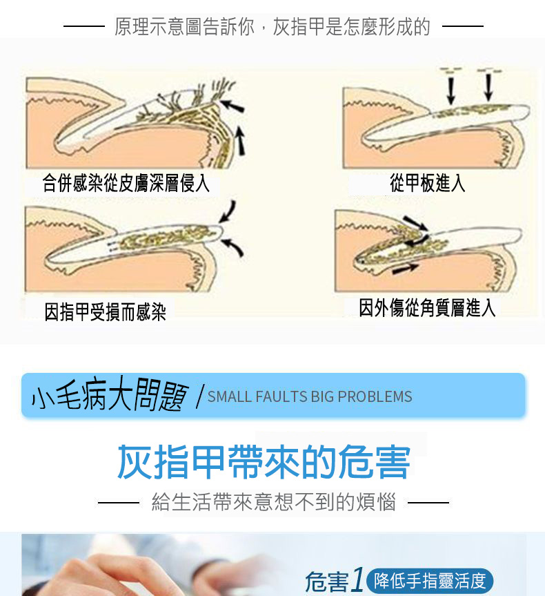 德國SOS灰指甲修復筆