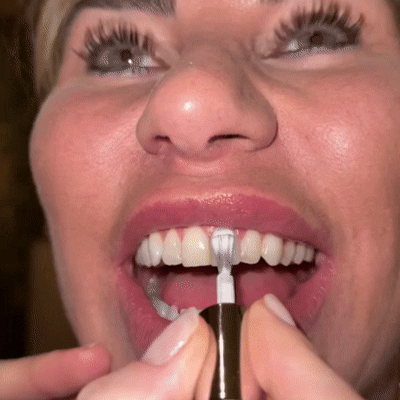 Miraloud™ Tooth Polish - Instant Clean Smile