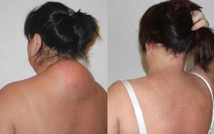 Caselast® Premium Curcumin Pain Relief Gel 27 Caselast® Premium Curcumin Pain Relief Gel