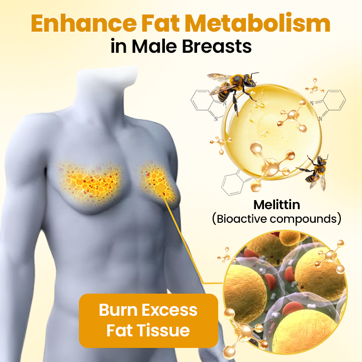 AnnieCare® ThermoFirm Bee Venom Gynecomastia-Oil 22 AnnieCare® ThermoFirm Bee Venom Gynecomastia-Oil