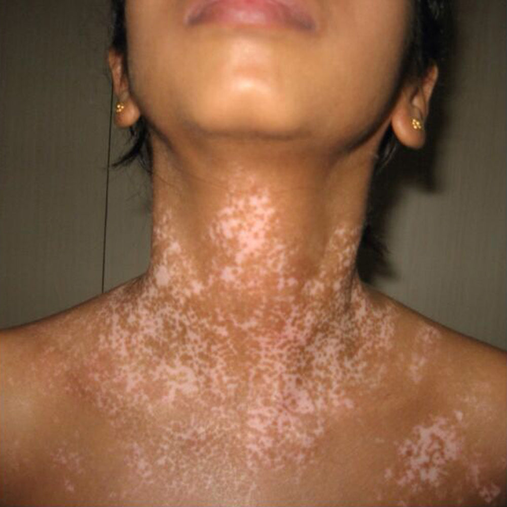 YUNPSO® VitiHeali Yellowjacket Neurotoxic fluid Extractm Cream Ultra 41 YUNPSO® VitiHeali Yellowjacket Neurotoxic fluid Extractm Cream Ultra