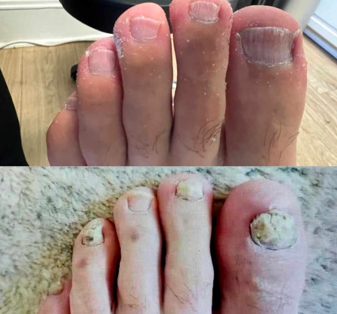 Biancat® AeroFilm Foot Defense Mist