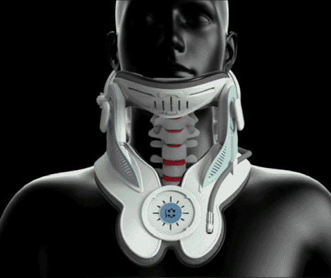 A modern cervical traction device designed to provide neck pain relief. The Cervitrax Gen-2 features an ergonomic design with adjustable straps, comfortable padding, and an easy-to-use inflation pump. The device is shown in use, supporting the user's neck and gently stretching the cervical spine for therapeutic benefits.