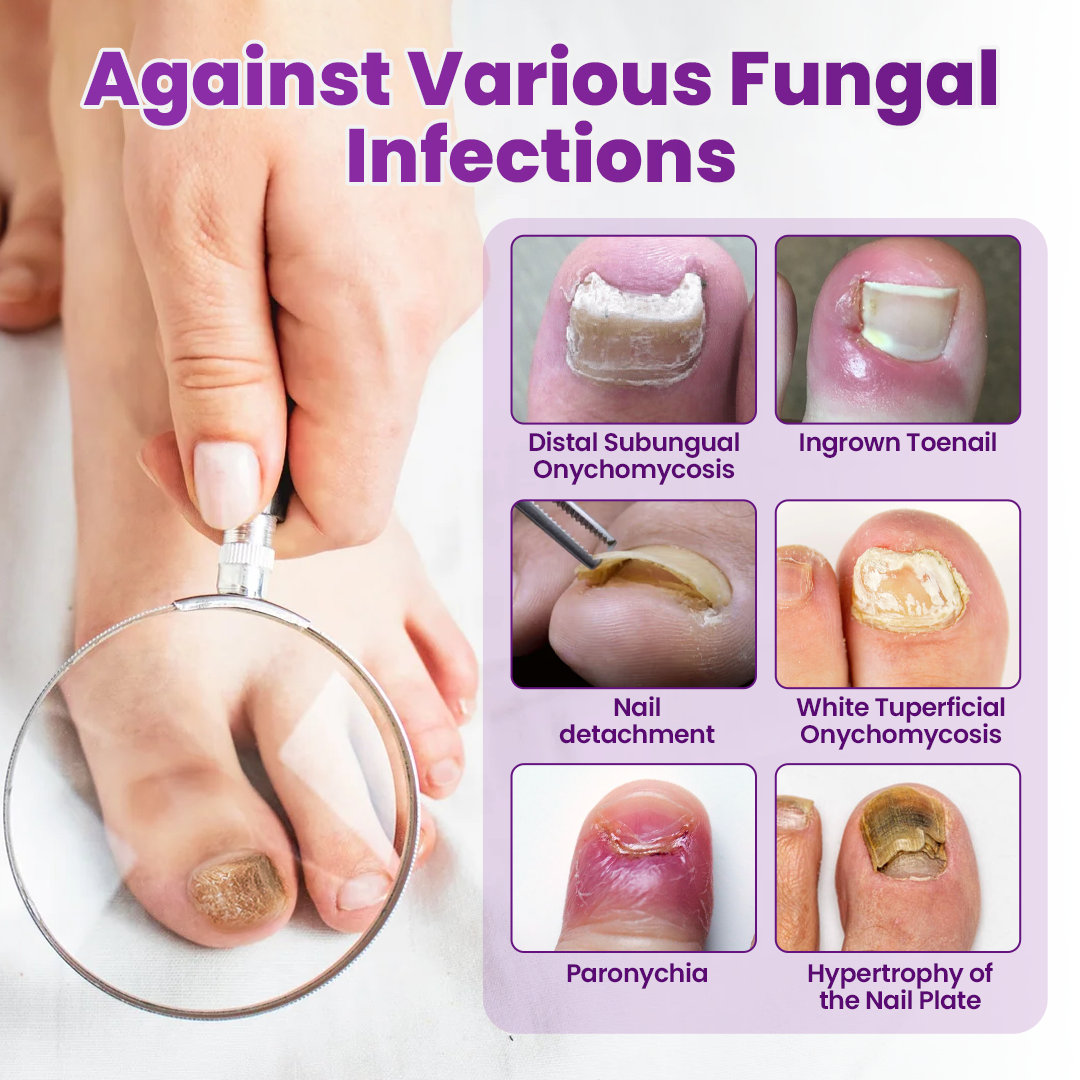 Biancat® AeroFilm Foot Defense Mist