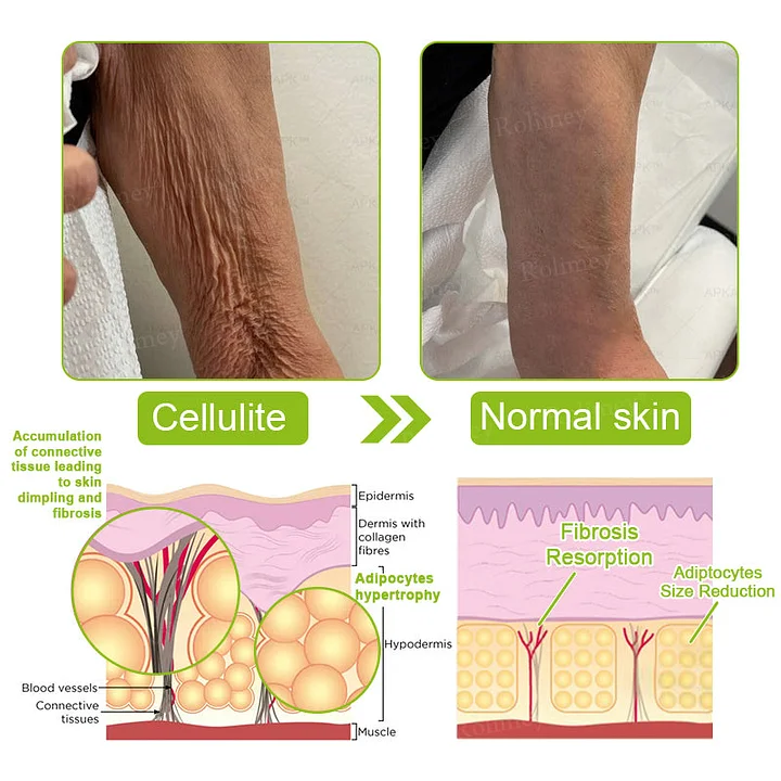 Rolimey® Botox & Vita-A Retinol Firming & Anti-Wrinkle Serum