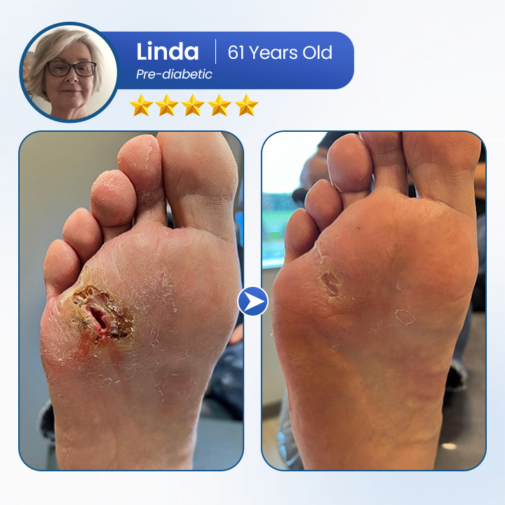 BQYOOM™ AngioVita Diabetic Care Spray