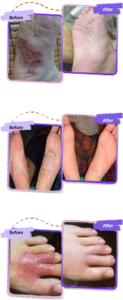 HZA™ FungiVanish Foot Treatment Spray