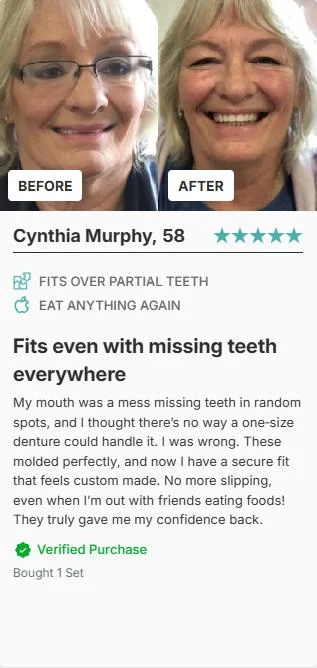 Cynthia Murphy Before After