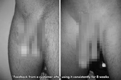 YUNPSO™ Vibrating Electric Male Masturbation Lock Ring (Charging) image YUNPSO™ Vibrating Electric Male Masturbation Lock Ring (Charging)