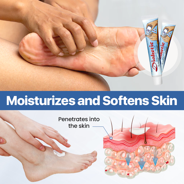 Biancat™ VitaGluco Diabetes Treatment Cream -👨‍⚕️ American Academy of Dermatology (AAD) Approved