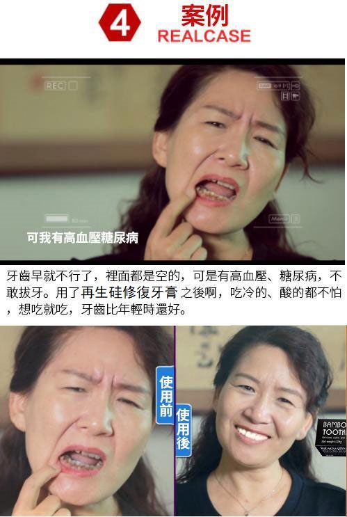 日本再生硅口腔抑菌牙膏