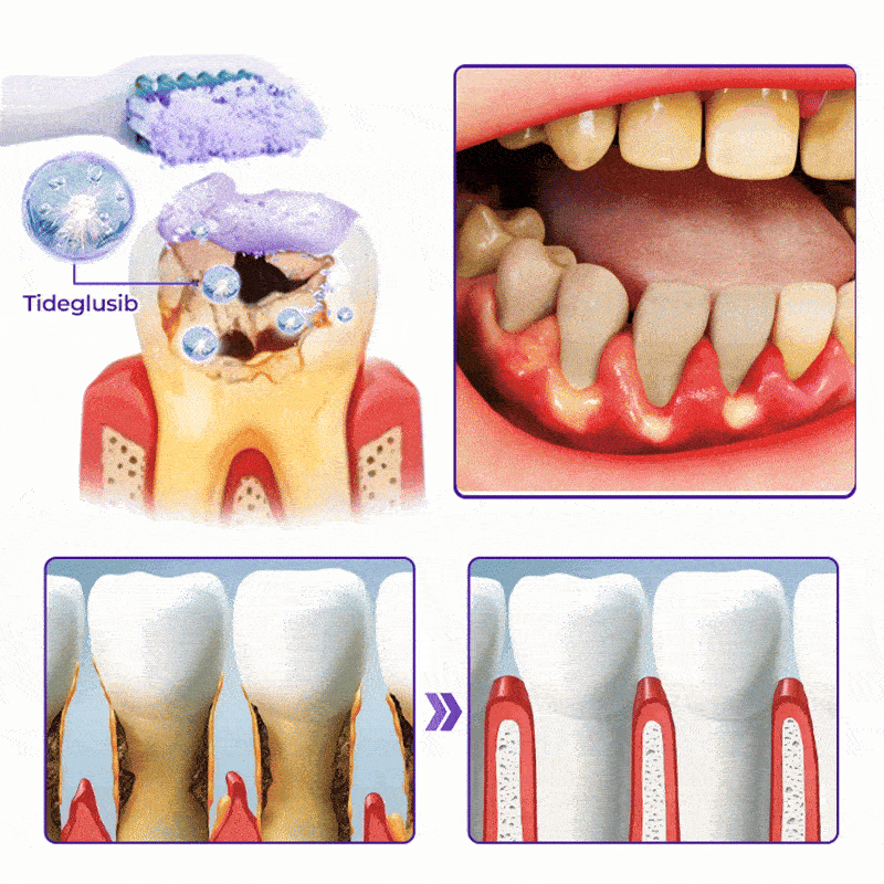LAOZIK™ Bee Poison Advanced Gum Healing Toothpaste 29 b9e29e8111ffef8f10917bf964ef52e1