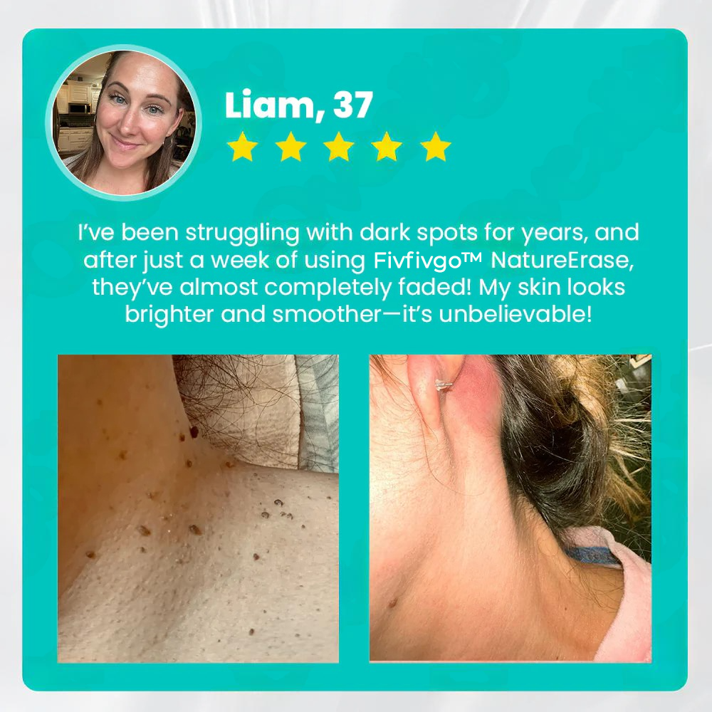 Fivfivgo™ NatureErase Instant Mole & Spot Removal Gel image Fivfivgo™ NatureErase Instant Mole & Spot Removal Gel