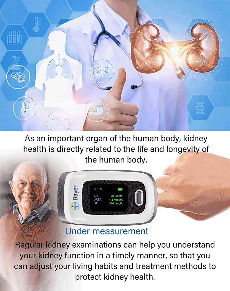 Examen de riñón.gif
