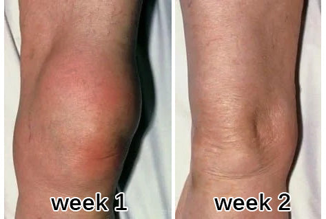 LAOZIK™ Turmeric & Emu Oil Arthritis Soothing Pain Relief Massage Gel Australian Osteopathic Association (AOA) Approved