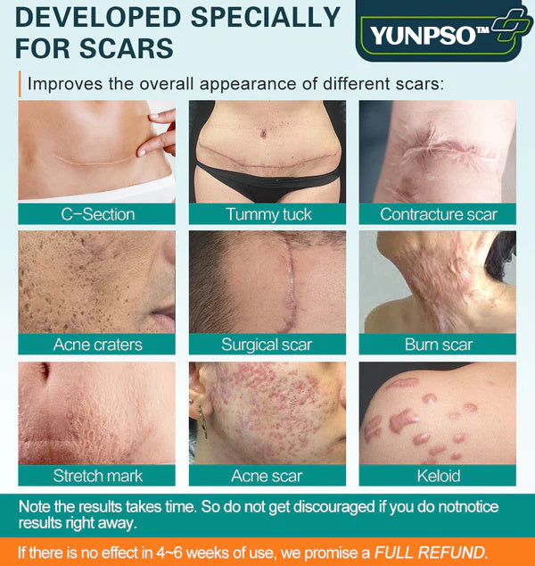 YUNPSO™ Advanced Scar Spray 28 bef240e0428afb437d1d9b28a75241c6