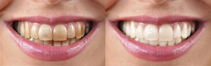 Rosopl® Multi-Action Oral Care Essence image Rosopl® Multi-Action Oral Care Essence