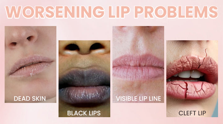 LIMETOW® Lip Plumper Kit image LIMETOW® Lip Plumper Kit