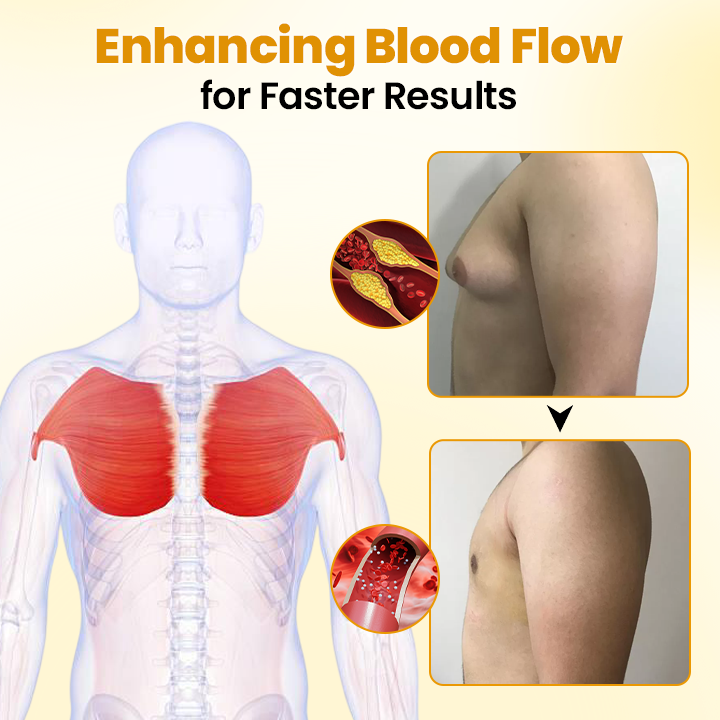 AnnieCare® ThermoFirm Bee Venom Gynecomastia-Oil 23 AnnieCare® ThermoFirm Bee Venom Gynecomastia-Oil