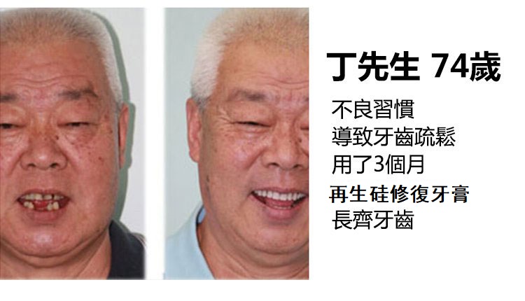 日本再生硅口腔抑菌牙膏