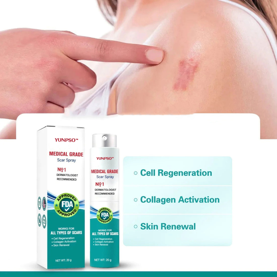 YUNPSO™ Advanced Scar Spray 30 c75b9de5019eb4165e3168fe83f3a4ef